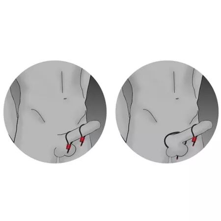 ELECTRASTIM - PRESTIGE ELECTRA LOOPS ANNEAUX PÉNIENS RÉGLABLES ROUGES